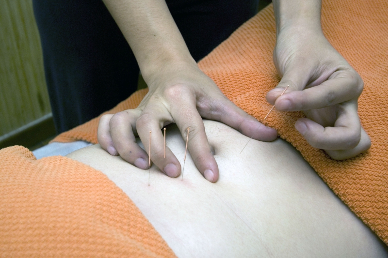 osteopathe-MANDELIEU LA NAPOULE-min_acupuncture-4175625